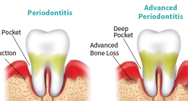 Salem Periodontal and Implant Specialist Salem Periodontal and Implant Specialist